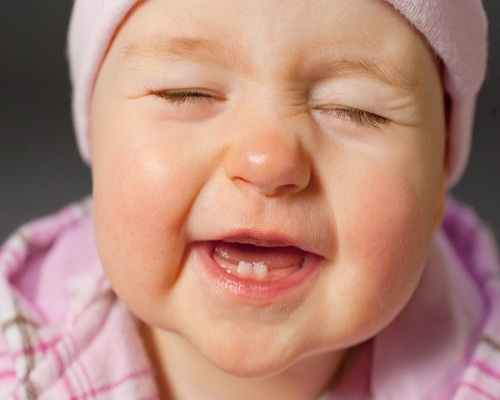 Những điều cần biết về răng sữa của trẻ